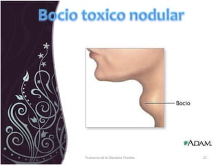 Trastorno de la Glandula Tiroides 