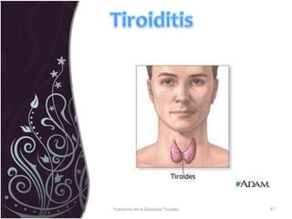 Trastorno de la Glandula Tiroides 