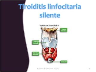 Trastorno de la Glandula Tiroides 