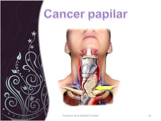 Trastorno de la Glandula Tiroides 