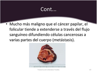 Cont... Mucho más maligno que el cáncer papilar, el folicular tiende a extenderse a través del flujo sanguíneo difundiendo células cancerosas a varias partes del cuerpo (metástasis).  Trastorno de la Glandula Tiroides 