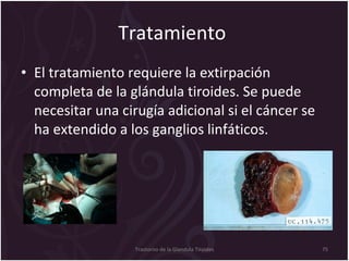 Tratamiento  El tratamiento requiere la extirpación completa de la glándula tiroides. Se puede necesitar una cirugía adicional si el cáncer se ha extendido a los ganglios linfáticos.  Trastorno de la Glandula Tiroides 