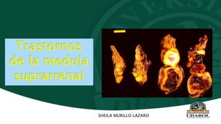 Trastornos
de la medula
suprarrenal
SHEILA MURILLO LAZARO
 