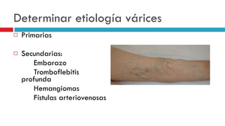Determinar etiolog í a v á rices Primarias Secundarias: Embarazo Tromboflebitis profunda Hemangiomas F í stulas arteriovenosas 
