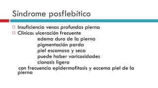 S í ndrome posfleb í tico Insuficiencia venas profundas pierna Cl í nica: ulceraci ó n frecuente edema duro de la pierna pigmentaci ó n parda piel escamosa y seca puede haber varicosidades cianosis ligera con frecuencia epidermofitosis y eccema piel de la pierna 