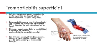 Tromboflebitis superficial Inflamación de una vena, justo debajo de la superficie de la piel, como resultado de un coágulo sanguíneo. Esta condición puede ocurrir después del uso reciente de un método intravenoso (IV) o después de un traumatismo en la vena.  Síntomas pueden ser dolor y sensibilidad a lo largo de la vena, endurecimiento(sensacion cuerda)  Los síntomas se resuelven de una a dos semanas, pero la dureza de la vena puede permanecer por mucho más tiempo.  