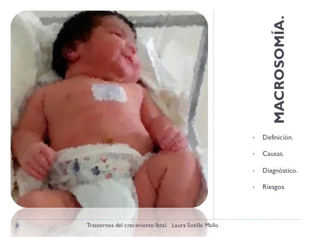 Trastornos del crecimiento fetal. Definición, causas y Trastornos del crecimiento fetal. Definición, causas y