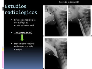 Estudios
radiológicos
 Evaluación radiológica
del esófago es
extremadamente util
 TRAGO DE BARIO
 Herramiento mas util
en los trastornos del
esófago
Fases de la deglución
 