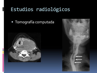 Estudios radiológicos
 Tomografía computada
 