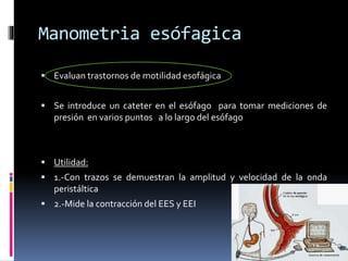 Manometria esófagica
 Evaluan trastornos de motilidad esofágica
 Se introduce un cateter en el esófago para tomar mediciones de
presión en varios puntos a lo largo del esófago
 Utilidad:
 1.-Con trazos se demuestran la amplitud y velocidad de la onda
peristáltica
 2.-Mide la contracción del EES y EEI
 