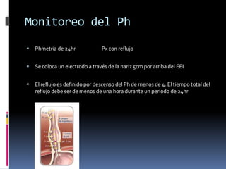 Monitoreo del Ph
 Phmetria de 24hr Px con reflujo
 Se coloca un electrodo a través de la nariz 5cm por arriba del EEI
 El reflujo es definido por descenso del Ph de menos de 4. El tiempo total del
reflujo debe ser de menos de una hora durante un periodo de 24hr
 