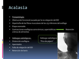 Acalasia
 Fisiopatología:
 Obstrucción funcional causada por la no relajación del EEI
 Hipertrofia de las fibras musculares de los 2/3 inferiores del esófago
 Etapa avanzada:
 Contracciones esofágicas asincrónicas y aperistálticas Retención
crónica de alimentos
 Hallazgos radiológicos: Hallazgo radiológico
 Distención esofágica “Pico de pájaro”
 Aperistalsis
 Falla de relajación del EEI
 Retención de bario
 