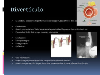 Divertículo
 Es una bolsa o saco creado por herniación de la capa mucosa a través de la pared muscular.
 Clasificación:
 Divertículos verdadero:Todas las capas de la pared del esófago estan dentro del diverículo
 Pseudodivertículo: Solo la capa mucosa y submucosa
 Localización:
 Faringoesofágico
 Esófago medio
 Epifrénicos
 Otra clasificación:
 Divertículos por pulsión:Asociados con presión intraluminal asociada
 Divertículos por tracción:Surgen de un tiron extraluminal de sitios de inflamación o fibrosis
 