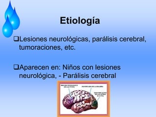 Etiología
Lesiones neurológicas, parálisis cerebral,
tumoraciones, etc.
Aparecen en: Niños con lesiones
neurológica, - Parálisis cerebral
 
