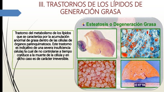 Preguntas sobre ralentizar metabolismo