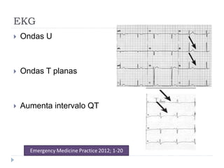 EKG
 Ondas U
 Ondas T planas
 Aumenta intervalo QT
 