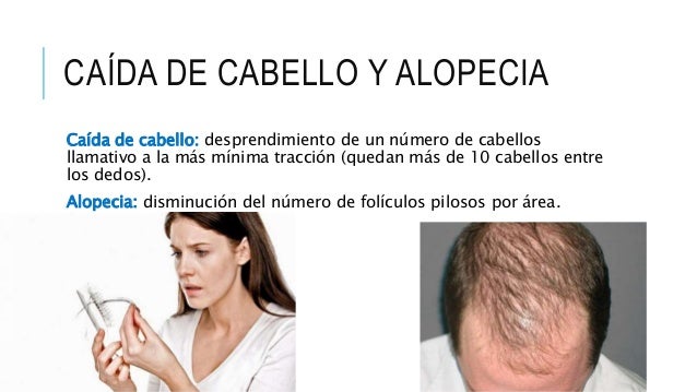 El foro que hacer si caen los cabellos sobre la cabeza