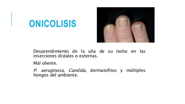 El nombre de la medicina para los pies del hongo