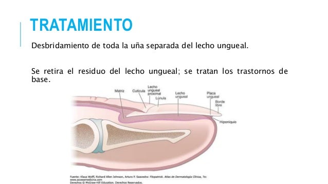 Si pueden estar enfermos los pies del hongo de las uñas