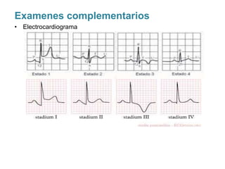 Examenes complementarios
• Electrocardiograma
 