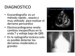 DIAGNOSTICO
• Ecocardiografía es un
método rápido , exacto y
muy utilizado para evaluar el
derrame pericardico
• Electrocardiograma revela
cambios inespecíficos en la
onda T y voltaje bajo de QRS
• En la radiografía torácica solo
es posible detectar los
derrames moderados a
grandes
 