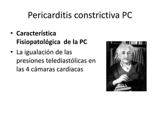Pericarditis constrictiva PC
• Característica
Fisiopatológica de la PC
• La igualación de las
presiones telediastólicas en
las 4 cámaras cardiacas
 