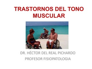 TRASTORNOS DEL TONO
MUSCULAR
DR. HÉCTOR DEL REAL PICHARDO
PROFESOR FISIOPATOLOGIA
 