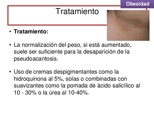 Trastornos endocrinos Trastornos endocrinos