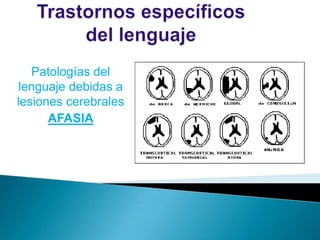 Patologías del
lenguaje debidas a
lesiones cerebrales
      AFASIA
 