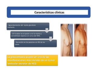 - Agrandamiento del tejido glandular
mamario.
- 25 % dolor en el pezón o en la mama y
sensibilidad objetiva en cerca del 40%.
- Secreción en los pezones en 4% de los
casos.
Características clínicas
La ginecomastia puede ser una de las
manifestaciones más iniciales de un tumor
testicular secretor de hCG.
 