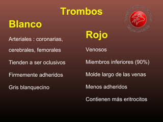Blanco
Arteriales : coronarias,
cerebrales, femorales
Tienden a ser oclusivos
Firmemente adheridos
Gris blanquecino
Rojo
Venosos
Miembros inferiores (90%)
Molde largo de las venas
Menos adheridos
Contienen más eritrocitos
Trombos
 