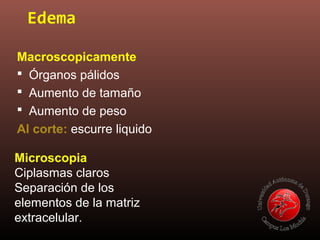 Edema
Macroscopicamente
 Órganos pálidos
 Aumento de tamaño
 Aumento de peso
Al corte: escurre liquido
Microscopia
Ciplasmas claros
Separación de los
elementos de la matriz
extracelular.
 