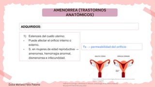 AMENORREA (TRASTORNOS
ANATÓMICOS)
ADQUIRIDOS:
1) Estenosis del cuello uterino:
- Puede afectar el orificio interno o
externo.
- S. en mujeres de edad reproductiva →
amenorrea, hemorragia anormal,
dismenorrea e infecundidad.
Tx → permeabilidad del orificio
https://stock.adobe.com/es/images/stenosis-of-uterine-cervix-human-
fertility/257530585
Dulce Mariana Félix Palomo Hoffman B, Schorge J, Bradshaw K. Williams. Ginecología. 4ª ed. Distrito Federal:
McGraw-Hill Interamericana; 2020.
 