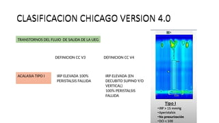 TRASTORNOS MOTORES ESOFÁGICOS CHICAGO 4.pptx
