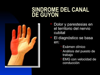 SINDROME DEL CANAL 
DE GUYON 
 Dolor y parestesias en 
el territorio del nervio 
cubital 
 El diagnóstico se basa 
en: 
...