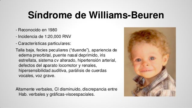 williams beuren syndrome essay williams beuren syndrome essay