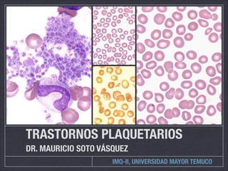 TRASTORNOS PLAQUETARIOS 
DR. MAURICIO SOTO VÁSQUEZ 
IMQ-II, UNIVERSIDAD MAYOR TEMUCO 
 