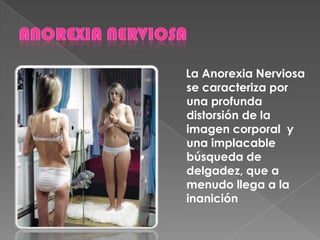 La Anorexia Nerviosa
se caracteriza por
una profunda
distorsión de la
imagen corporal y
una implacable
búsqueda de
delgadez, que a
menudo llega a la
inanición
 