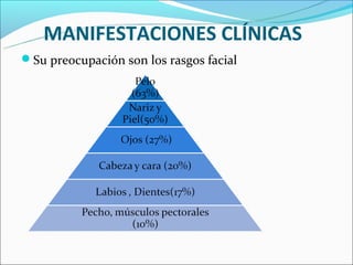 MANIFESTACIONES CLÍNICAS
Su preocupación son los rasgos facial
 