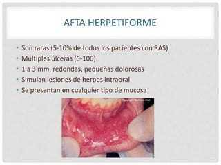 Lesiones Raras Trastornos ulcerativos | PPTX