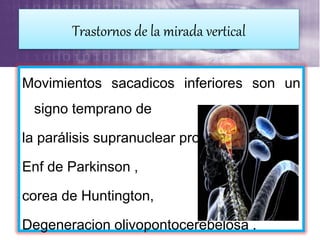 Movimientos sacadicos inferiores son un
signo temprano de
la parálisis supranuclear progresiva.
Enf de Parkinson ,
corea de Huntington,
Degeneracion olivopontocerebelosa .
Trastornos de la mirada vertical
 