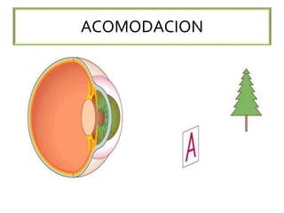 ACOMODACION
 