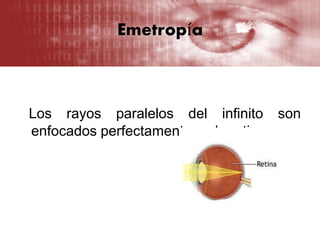 Emetropía
Los rayos paralelos del infinito son
enfocados perfectamente en la retina.
 