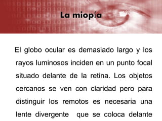 La miopía
El globo ocular es demasiado largo y los
rayos luminosos inciden en un punto focal
situado delante de la retina. Los objetos
cercanos se ven con claridad pero para
distinguir los remotos es necesaria una
lente divergente que se coloca delante
 