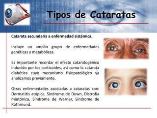 Tipos de Cataratas
Catarata secundaria a enfermedad sistémica.
Incluye un amplio grupo de enfermedades
genéticas y metabólicas.
Es importante recordar el efecto cataratogénico
inducido por los corticoides, así como la catarata
diabética cuyo mecanismo fisiopatológico ya
analizamos previamente.
Otras enfermedades asociadas a cataratas son:
Dermatitis atópica, Síndrome de Down, Distrofia
miotónica, Síndrome de Werner, Síndrome de
Rothmund.
 
