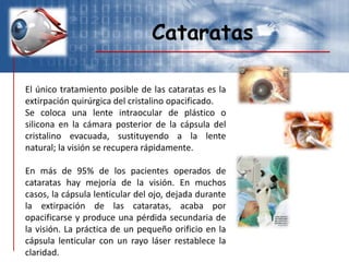 Cataratas
El único tratamiento posible de las cataratas es la
extirpación quirúrgica del cristalino opacificado.
Se coloca una lente intraocular de plástico o
silicona en la cámara posterior de la cápsula del
cristalino evacuada, sustituyendo a la lente
natural; la visión se recupera rápidamente.
En más de 95% de los pacientes operados de
cataratas hay mejoría de la visión. En muchos
casos, la cápsula lenticular del ojo, dejada durante
la extirpación de las cataratas, acaba por
opacificarse y produce una pérdida secundaria de
la visión. La práctica de un pequeño orificio en la
cápsula lenticular con un rayo láser restablece la
claridad.
 