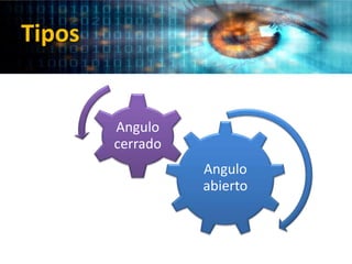 Tipos
Angulo
abierto
Angulo
cerrado
 