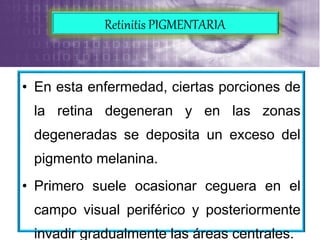 • En esta enfermedad, ciertas porciones de
la retina degeneran y en las zonas
degeneradas se deposita un exceso del
pigmento melanina.
• Primero suele ocasionar ceguera en el
campo visual periférico y posteriormente
invadir gradualmente las áreas centrales.
Retinitis PIGMENTARIA
 