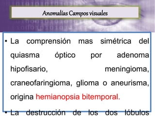 • La comprensión mas simétrica del
quiasma óptico por adenoma
hipofisario, meningioma,
craneofaringioma, glioma o aneurisma,
origina hemianopsia bitemporal.
• La destrucción de los dos lóbulos
Anomalías Campos visuales
 