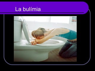 La bulímia  